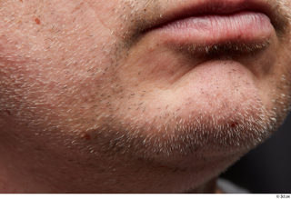 HD Face Skin Yury chin face lips mouth skin pores…